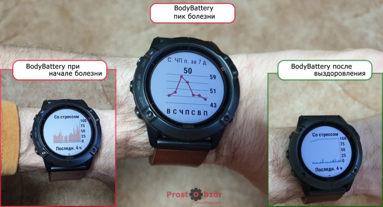 Пример болезни с отображением пульса в состояния покоя и BodyBattery