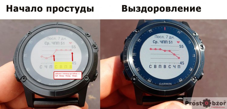 Пульс в состояния покоя при болезни - RHR